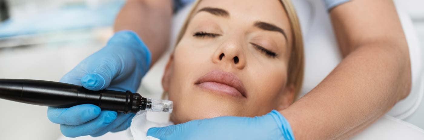 Anti-Aging Behandlung mit MicroNeedling Anti-Aging Behandlung mit MicroNeedling