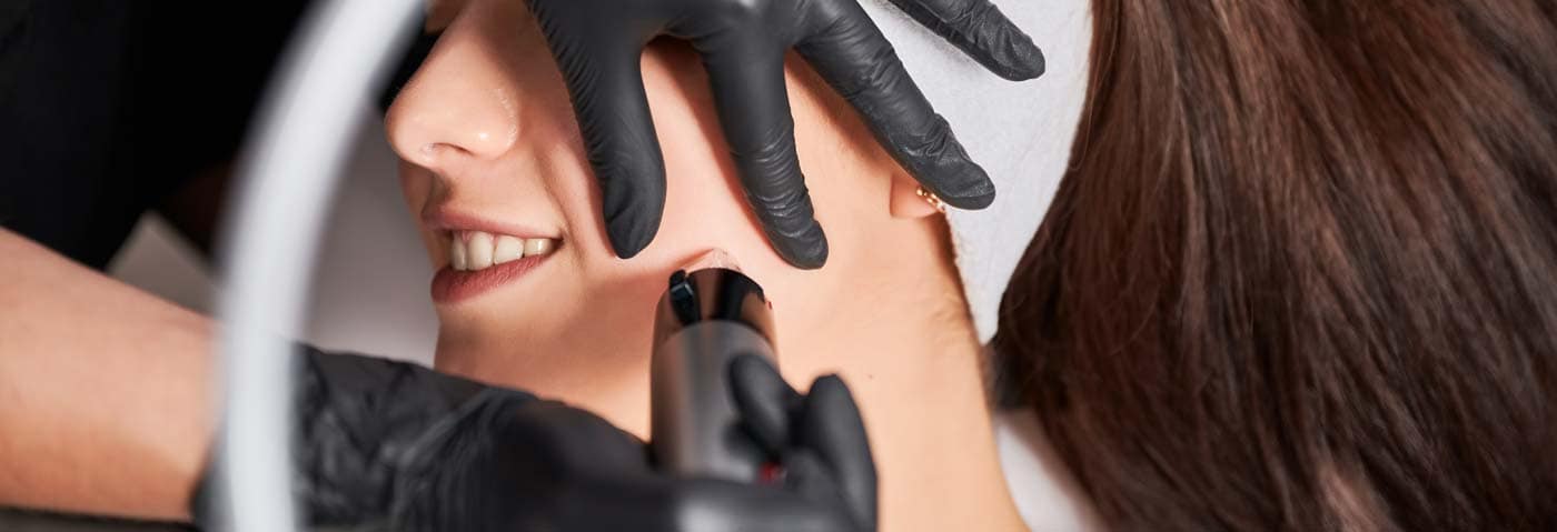 Medical MicroNeedling in Zürich Medical Microneedling in Zürich