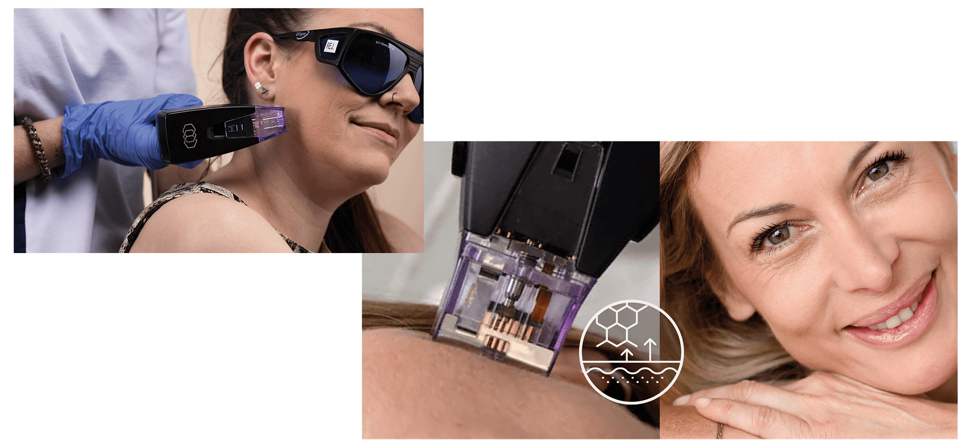 DZ Collage Hautverjüngung Morpheus ()