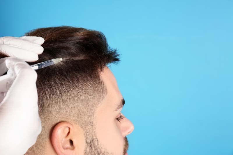 Mesohair-Behandlung gegen Haarausfall Mesohair-Behandlung gegen Haarausfall