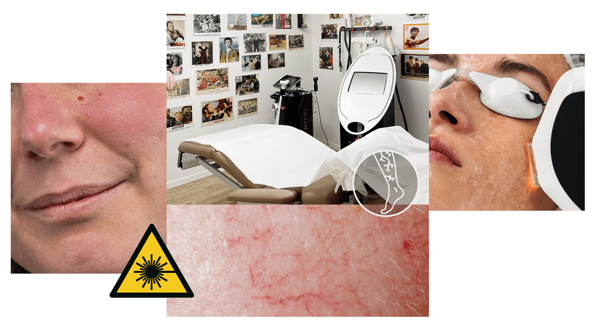 DZ Collage Aederchen DZ Collage Aederchen