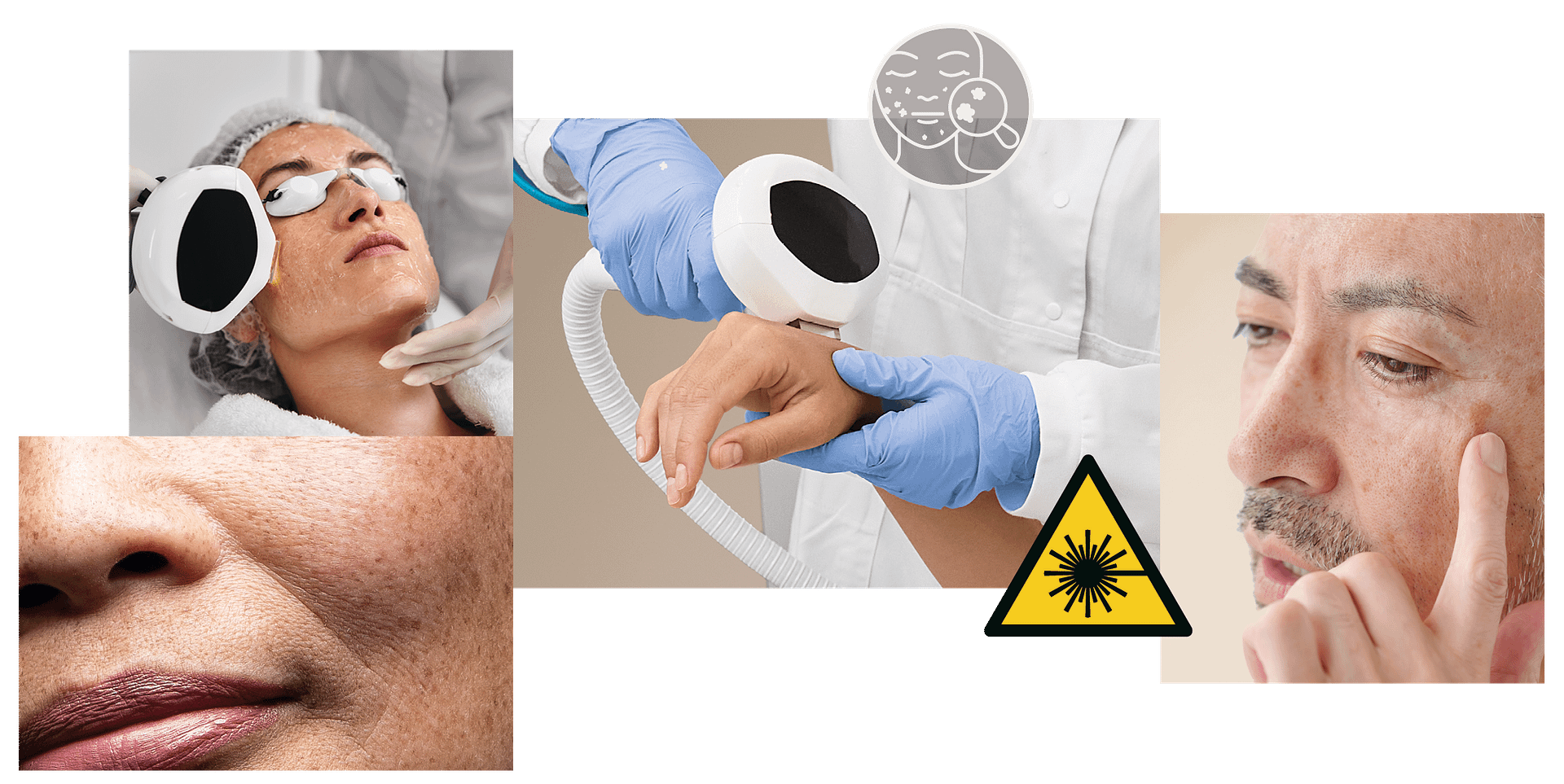 DZ Collage Altersflecken DZ Collage Altersflecken