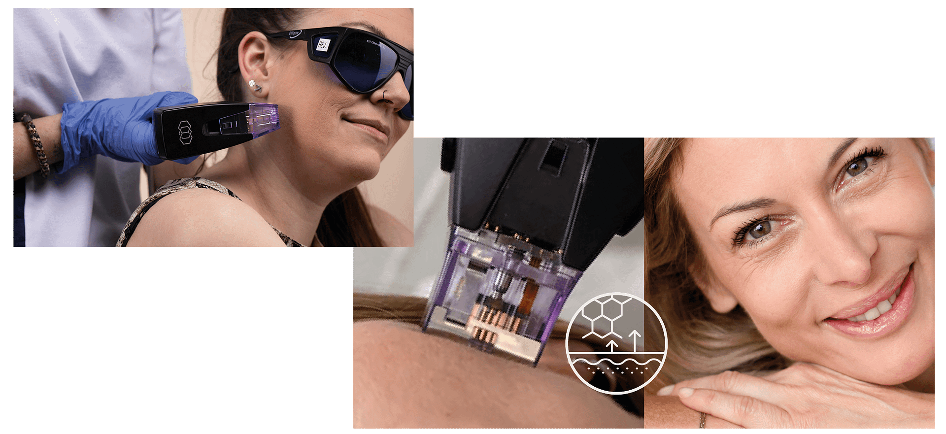 DZ Collage Hautverjüngung Morpheus () DZ Collage Hautverjüngung Morpheus ()